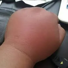 도라에몽 손을 가진 남자의 근황.jpg 손에 살 좀 빠진 듯 ㅋㅋㅋㅋㅋ